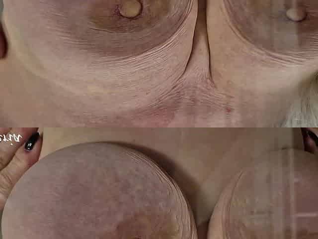 The Old Woman Pees