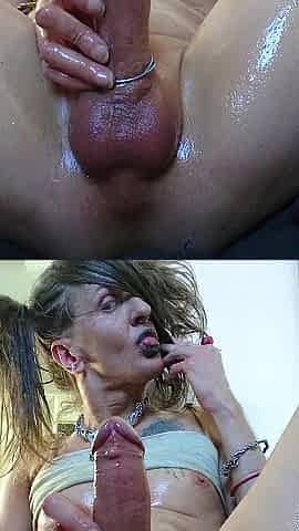 PROLAPSING CAMELTOE