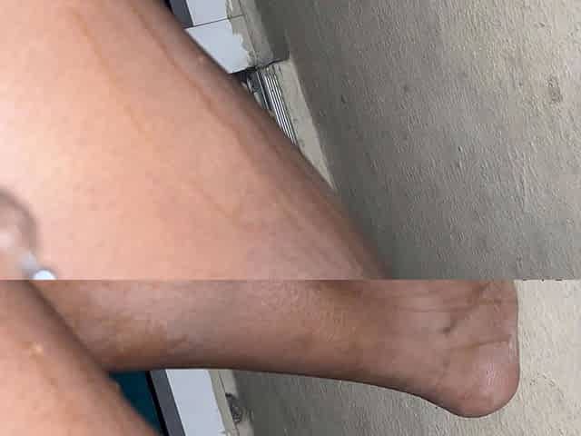 onlyfans palm-balcony