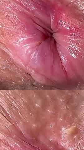 18 Years Old Girl with Yummy Butthole Vs 45 Years Old German Man