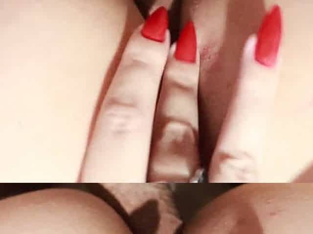 Anal invasion