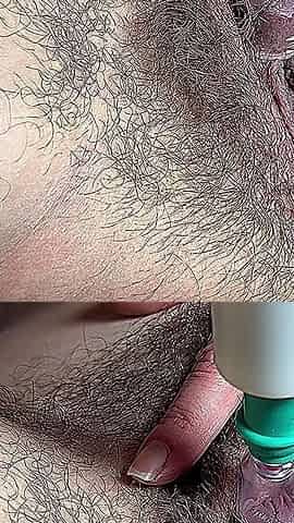 Hairy Mommy Clitoris Pumping,very Hot