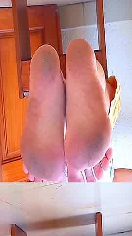 My Dirty Soles After Outdoor Walk