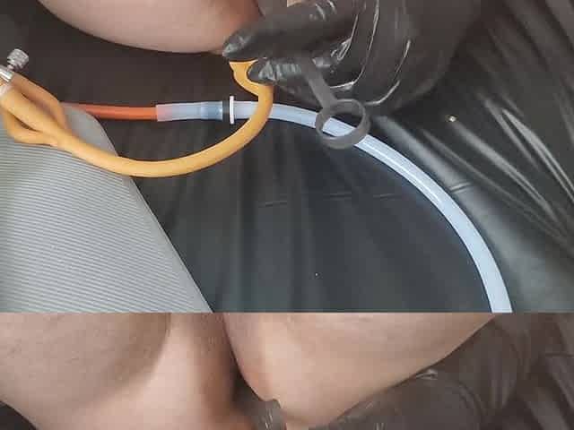 Receiving the enema using enema machine with bardex inflatable nozzle for str8 chap