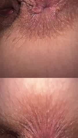My Dick Is a Catheter and Her Feet Are a Hepatitis. This Way I Can Cum Faster.