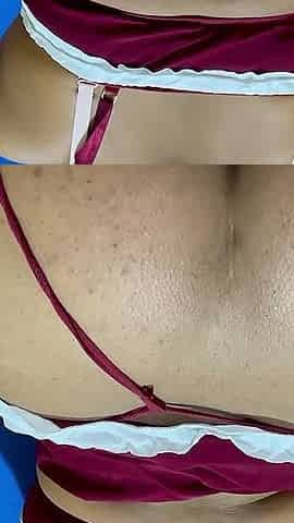 Indian Sexy Nurse with Sick Person Hard Fucking in House