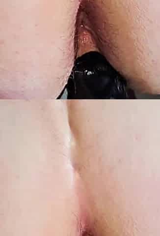 BBW Anal Compilation 2#