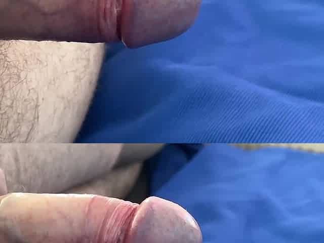 Masturbate prostate. How to squeeze cum throughout the butt
