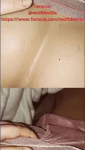 INTENSIVE STEP SIS ANAL RENCOUNTER