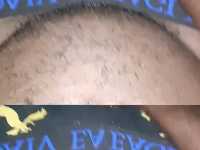 Holding Pee But Bladder Bulge Pissing Myself Screw - Piddle Relief #three
