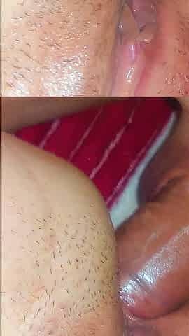 Short anal