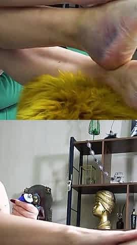 Sprained Ankle Fetish
