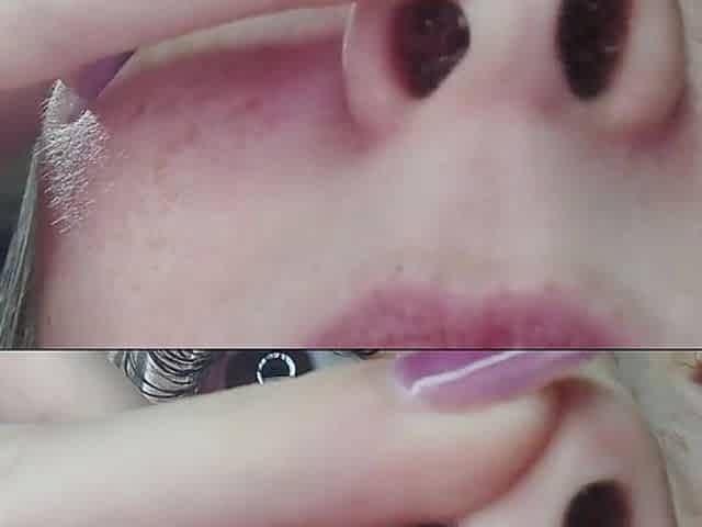 Runny Nose Close up