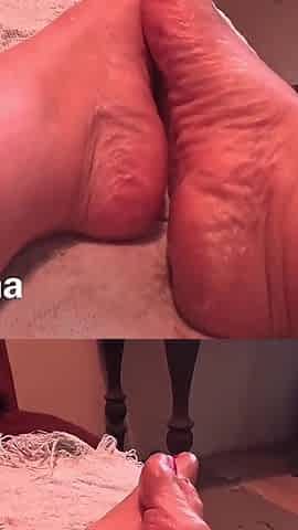 My Feet Need Lotion