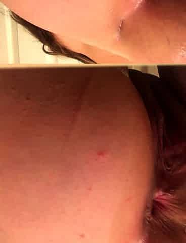 StripCamFun Amateur Webcam Anal Amateur Anal Porn Video