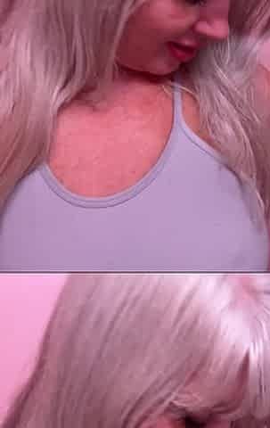 Why Are My Nipples so Hard All the Time?