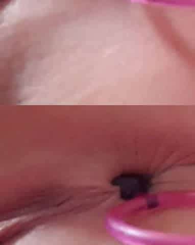 Anal Masturbation