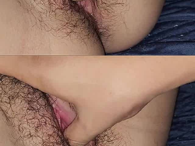 Hairy Teen