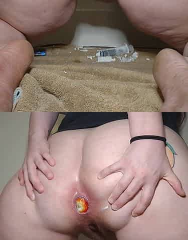 Hot big beautiful woman fills her butthole with Strawberries and Cream for u