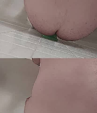 Anal veiws
