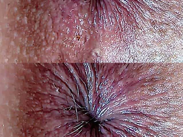 Extreme Close Up Anal Play And Fingering Asshole 30 Min