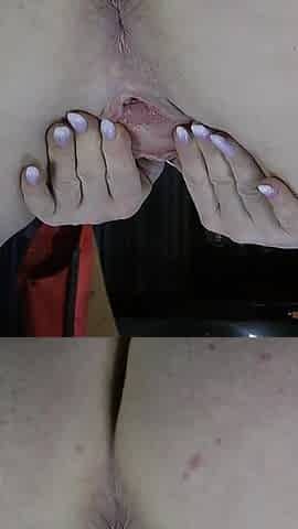 Labia Spreading Close up 1
