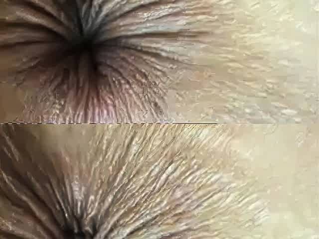Winking Butthole Close-Up on Webcam
