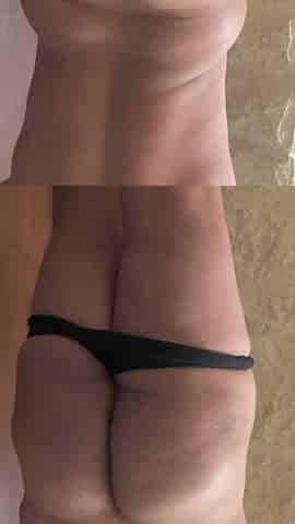 Large soft butt