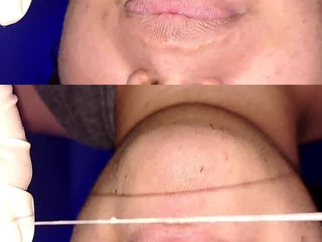 Trying to Use Dental Floss (close-up)