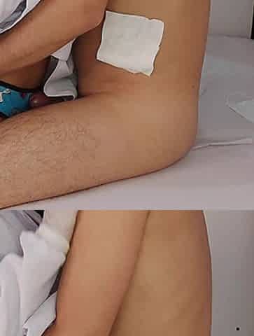 Skinny Nurse Observes Patient's Erection