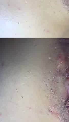 Fat Pumped Pussy Play