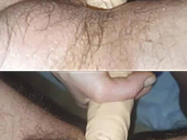 Complications. Wife Fucks Her Husband's Ass with a Big Dildo