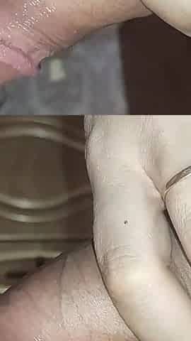 Black Fingernails