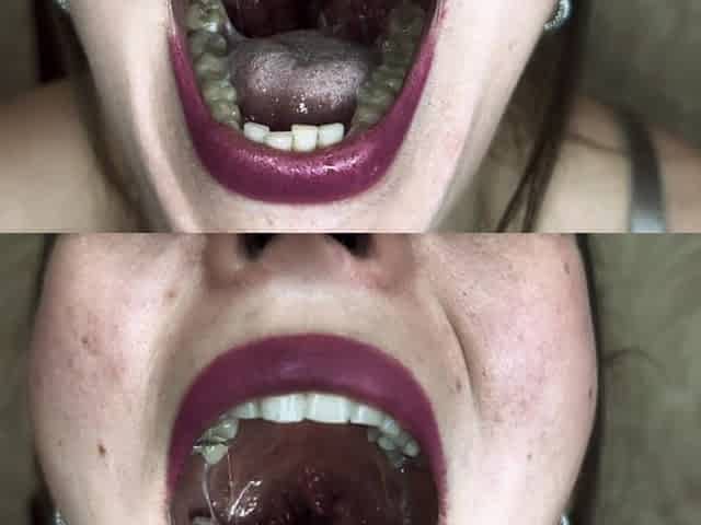 Mucus Mastery Lips with Lipstick & Spit in Glass