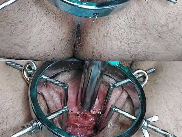 [MOVIE] Peehole Sounding, Beads, and Glass Toys