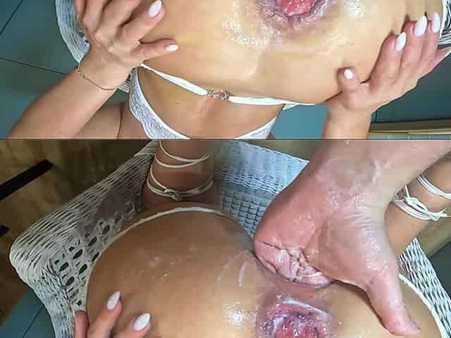 Extreme Fisting
