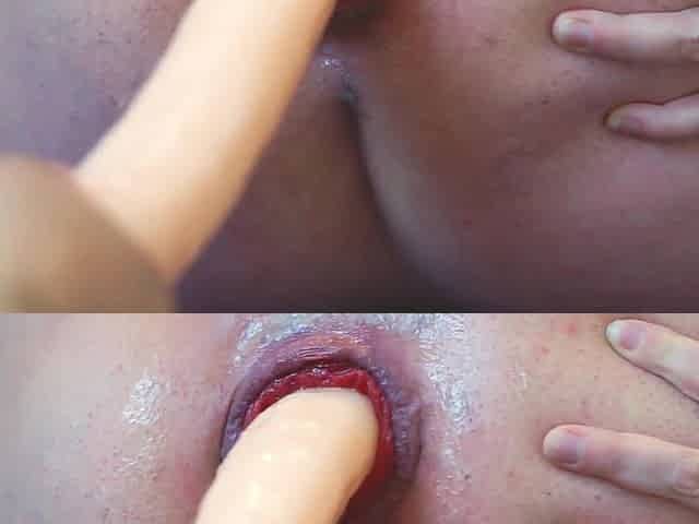 Anal Slut Gets Cock in Her Huge Prolapsed Ass