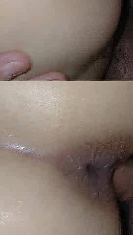 Anal and Vagina