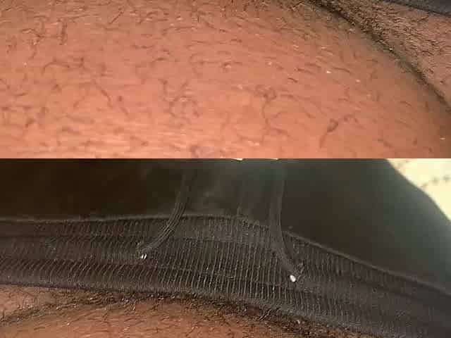 Holding Pee But Bladder Bulge - 001