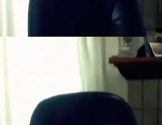 Hairy Webcam Girl in Wheelchair Shows Off