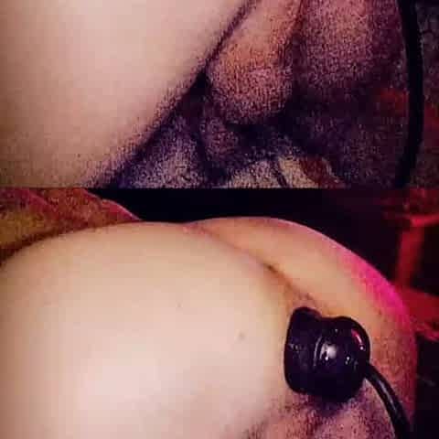 Stretch anus vacuum pump