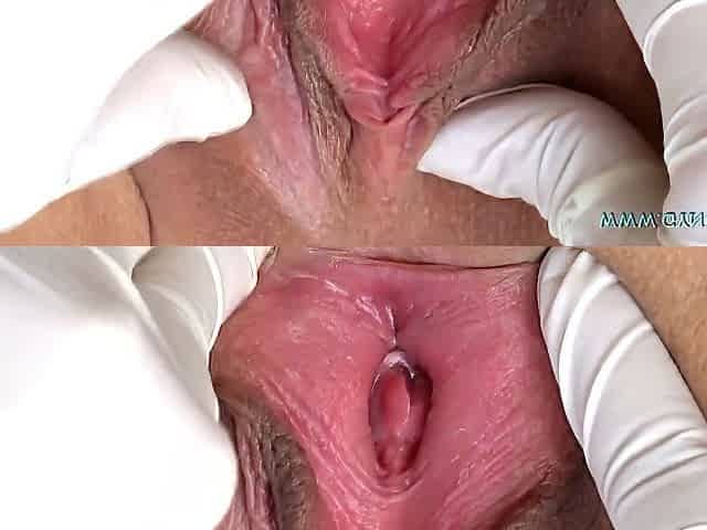 Young Skinny Lady Needs Gyno Exam By Kinky Female Doctor