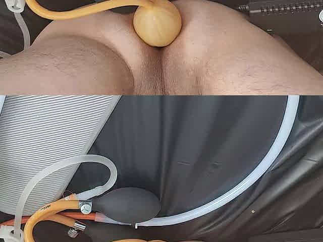Receiving the enema using enema machine with bardex inflatable nozzle for str8 man