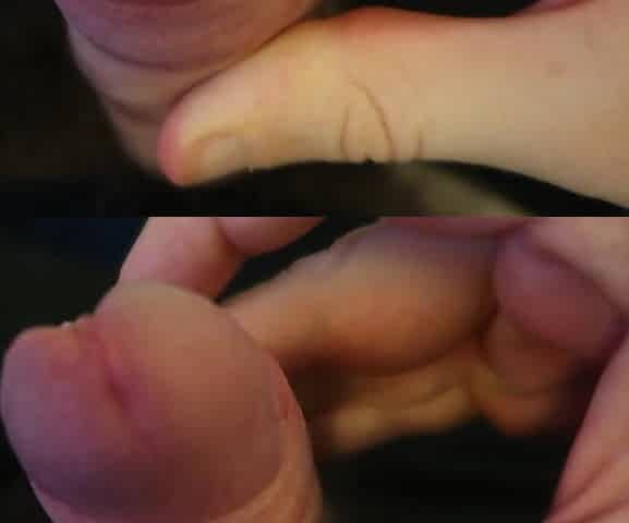 Playing with Foreskin (1080p HD)