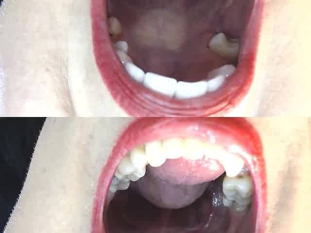 Inside My Big Mouth Tongue Teeth Uvula