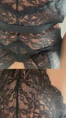 Vagina Ingrown Hair Pussy Spot Explode