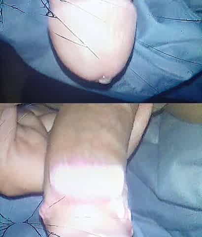 Quick cum discharged