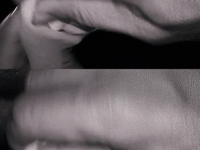 A metal dilator in the boy urethra. Valuable ramrod!