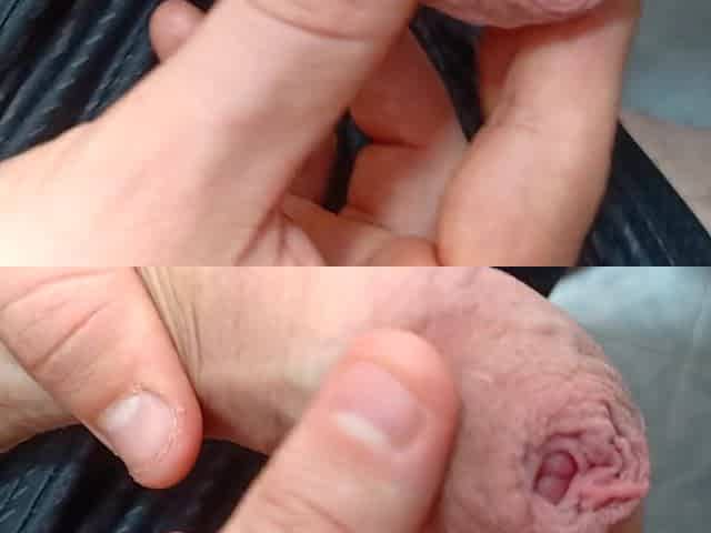 constricted foreskin big ramrod play- playing with my uncut foreskin phimosis knob