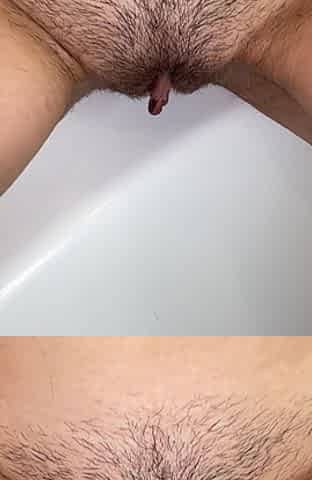 Epilation of Armpits with an Epilator! Shaving Hairy Armpits! Depilation!